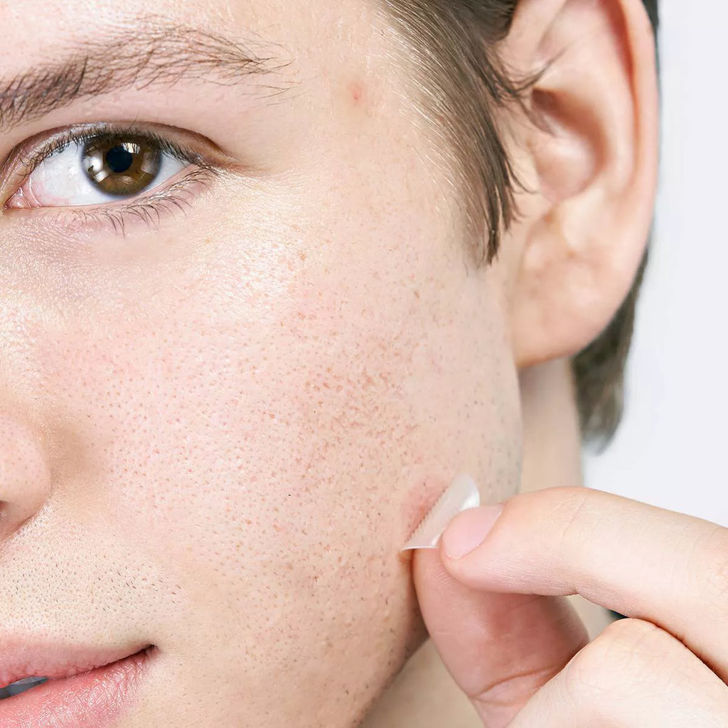 Hero Mighty Patch Micropoint for Blemishes - 8ct | Paraben-Free, Sulfate-Free, with Salicylic Acid for Acne-Prone Skin