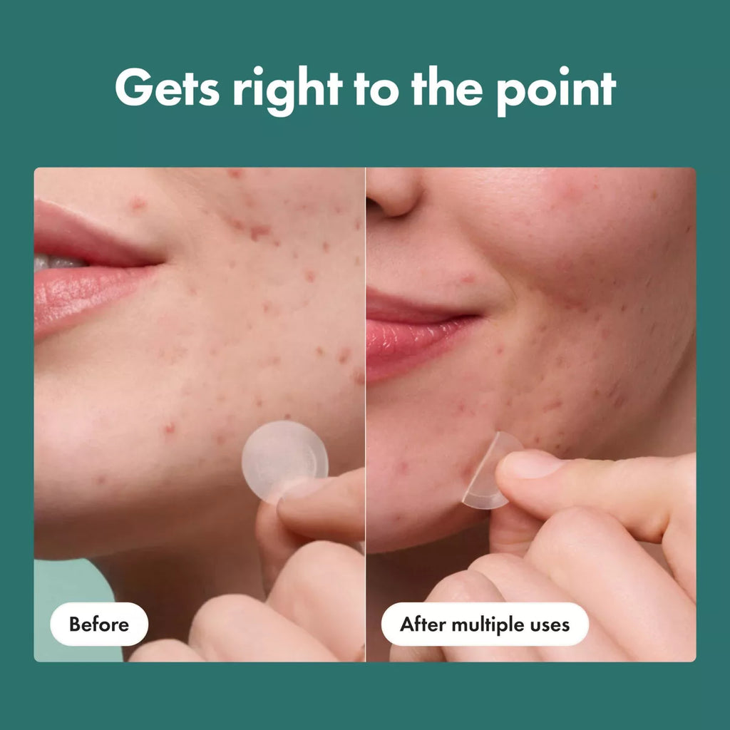 Hero Mighty Patch Micropoint for Blemishes - 8ct | Paraben-Free, Sulfate-Free, with Salicylic Acid for Acne-Prone Skin