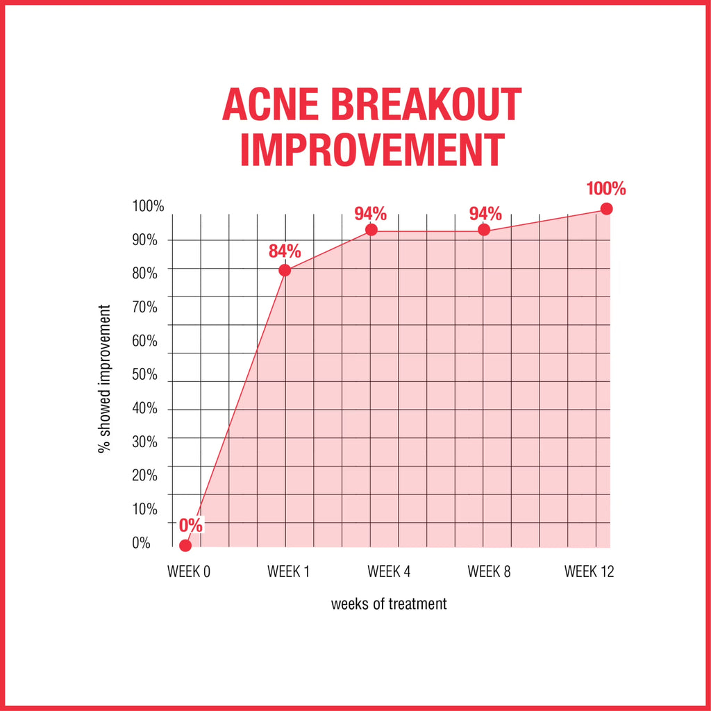 Powerful Stubborn Acne AM Treatment with 2.0% Benzoyl Peroxide - 2 Oz